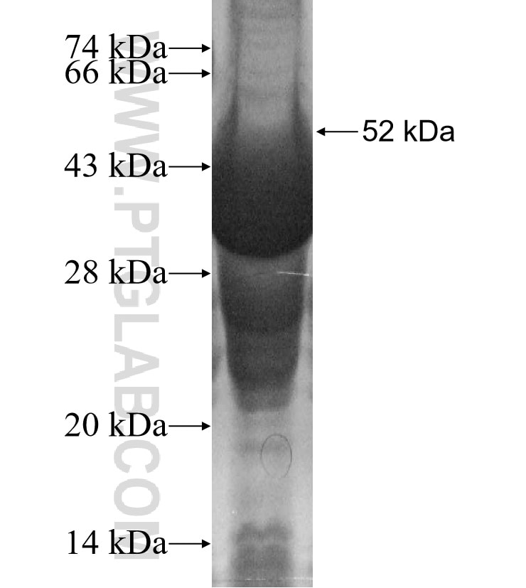 ERMP1 fusion protein Ag11297 SDS-PAGE