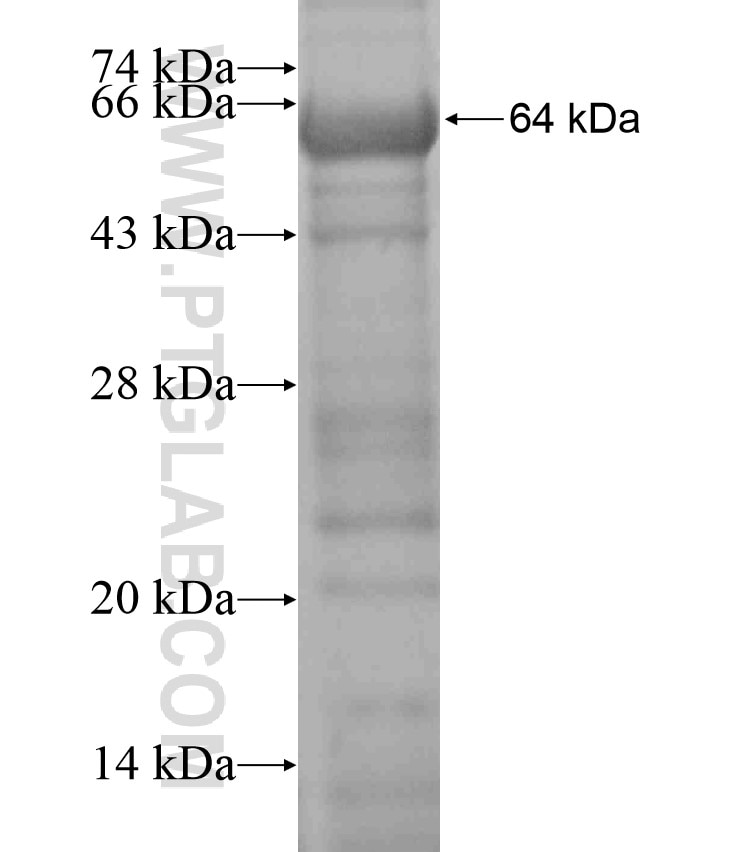 IRE1; ERN1 fusion protein Ag17504 SDS-PAGE