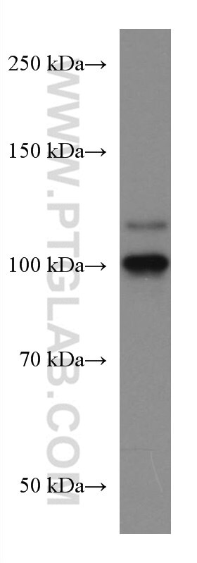 Western Blot (WB) analysis of A549 cells using ERN2 Monoclonal antibody (67289-1-Ig)