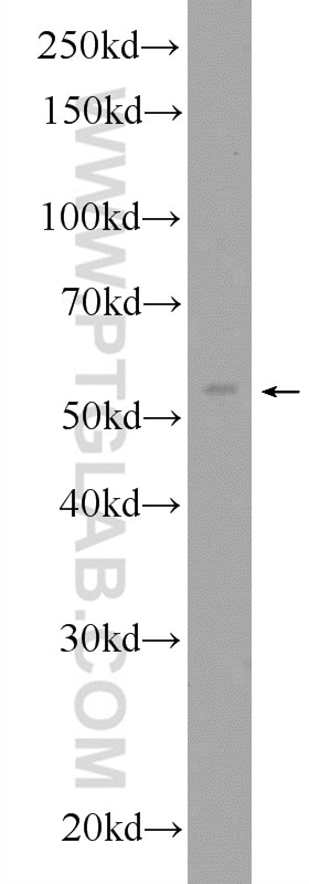 Western Blot (WB) analysis of A431 cells using ERO1L Polyclonal antibody (12007-1-AP)
