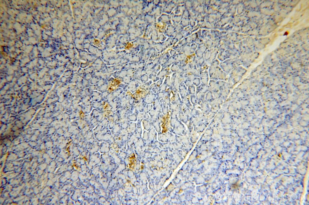 IHC staining of human pancreas using 18313-1-AP