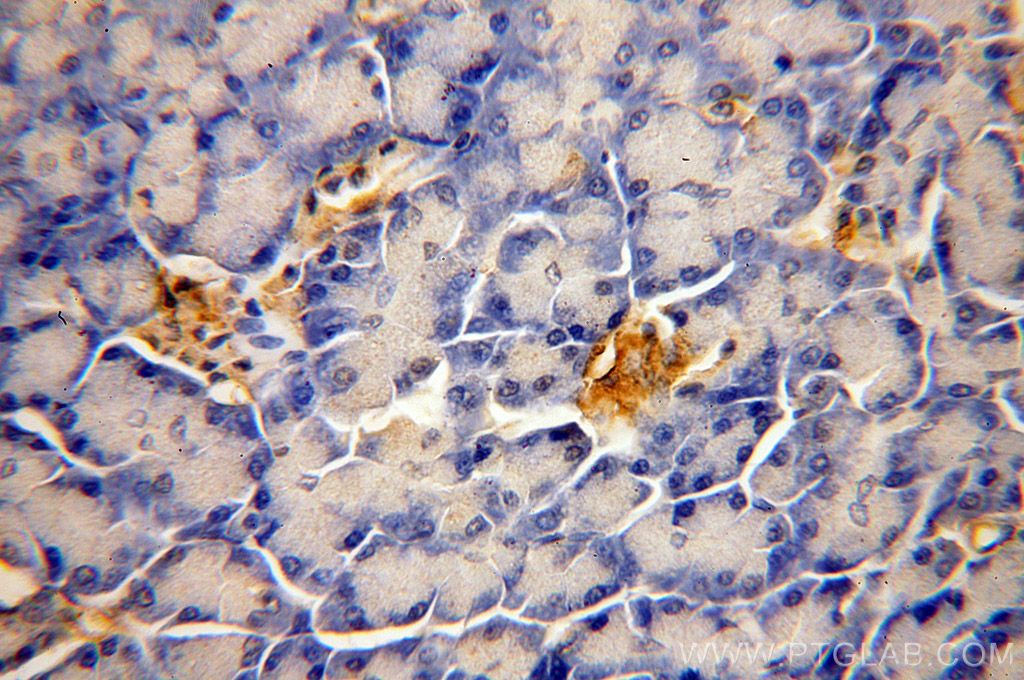 Immunohistochemistry (IHC) staining of human pancreas tissue using ERO1L Polyclonal antibody (18313-1-AP)