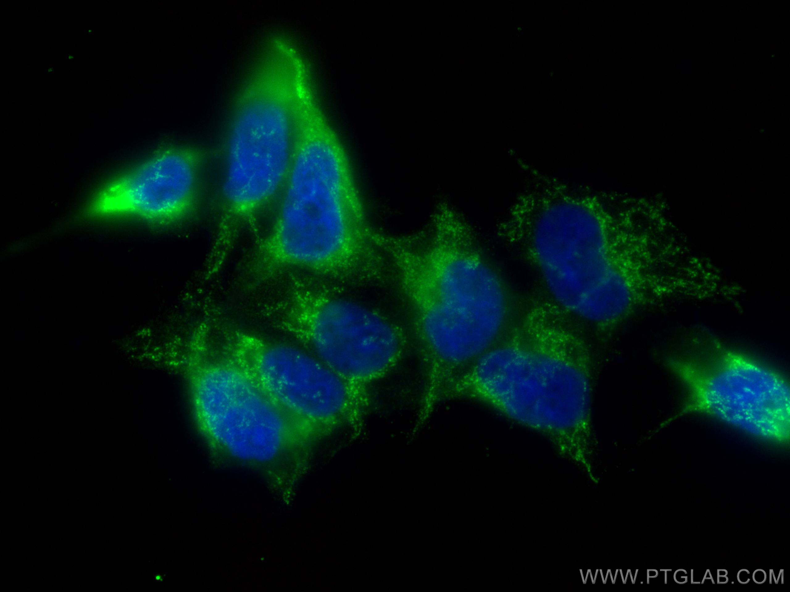 Immunofluorescence (IF) / fluorescent staining of HEK-293 cells using ERO1L Monoclonal antibody (67416-1-Ig)