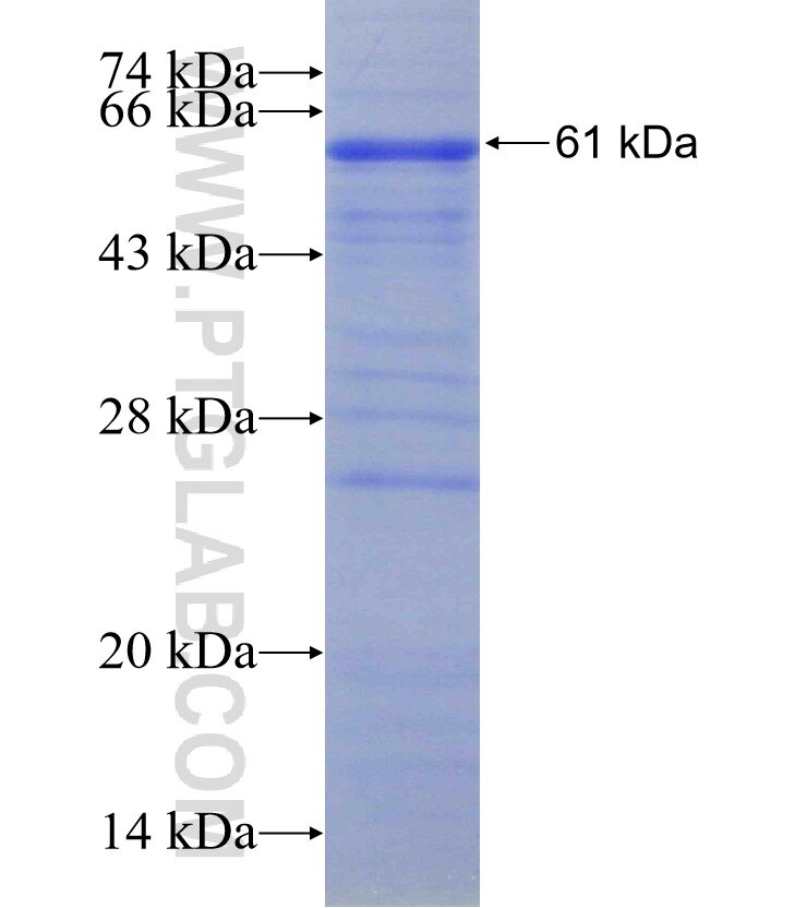 ERO1L fusion protein Ag29910 SDS-PAGE
