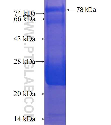 ERO1L fusion protein Ag2620 SDS-PAGE