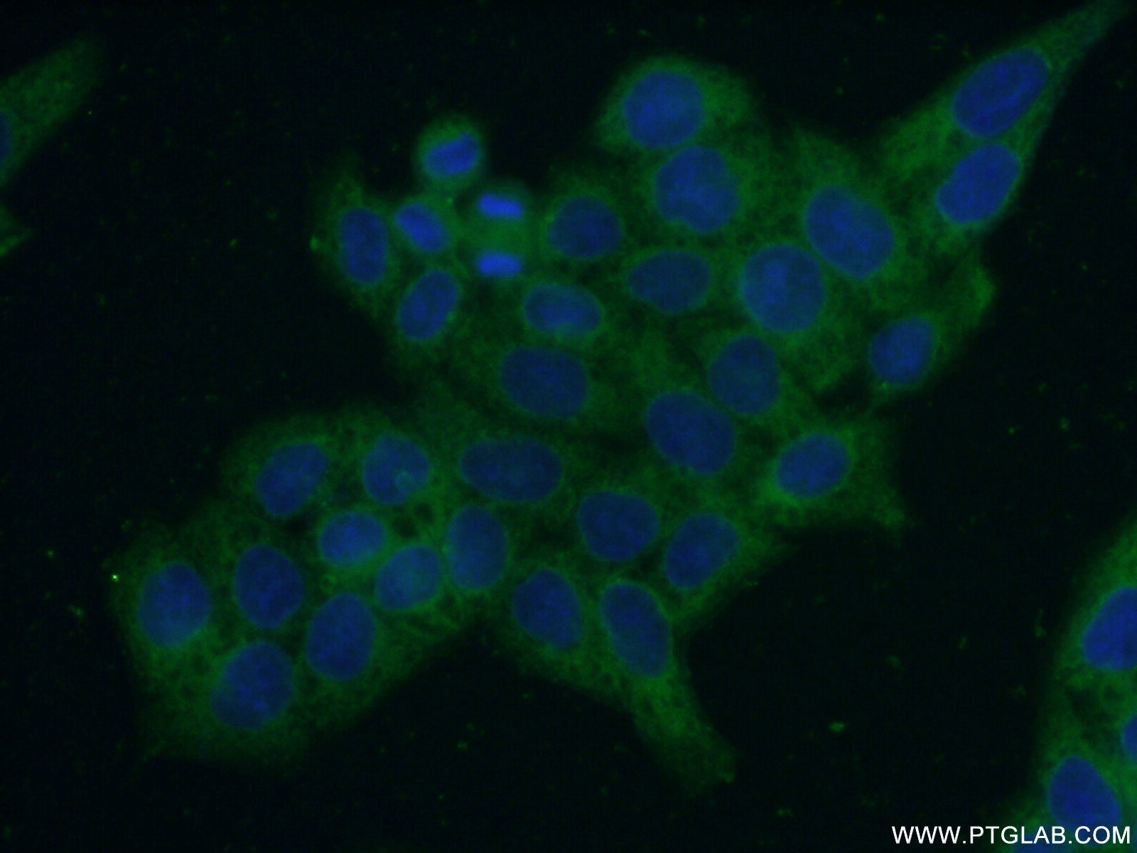 Immunofluorescence (IF) / fluorescent staining of HeLa cells using ERO1LB Polyclonal antibody (11261-2-AP)