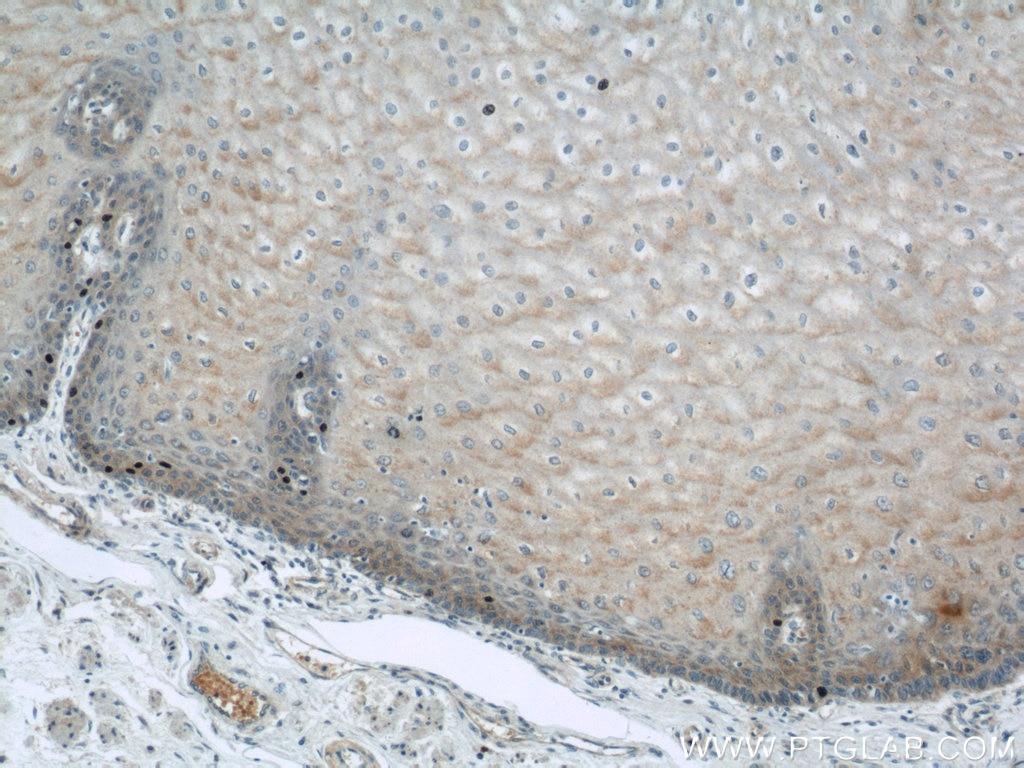 Immunohistochemistry (IHC) staining of human oesophagus tissue using ERO1LB Polyclonal antibody (11261-2-AP)