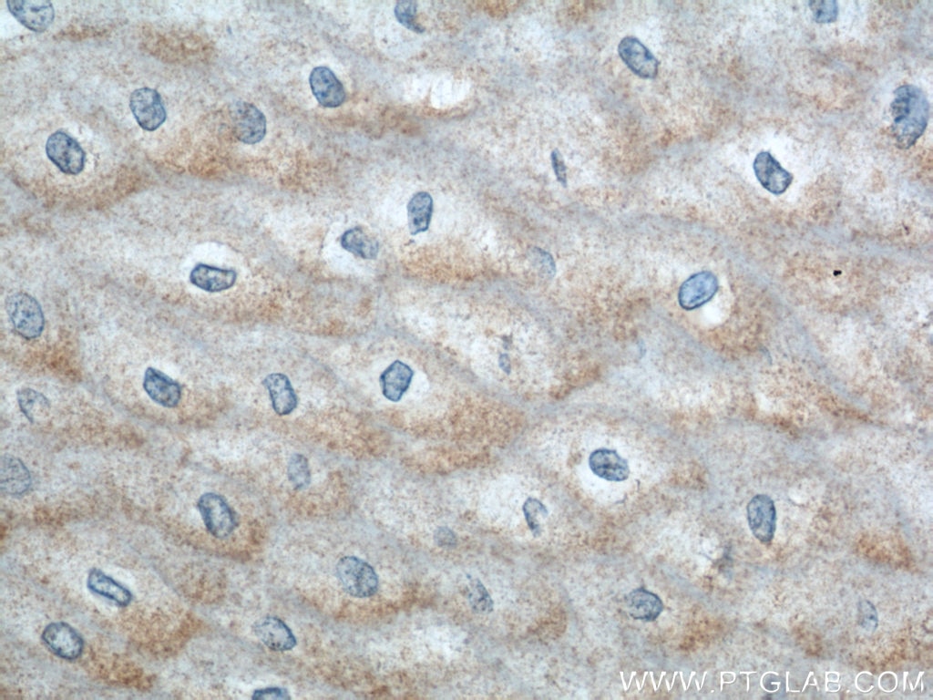 Immunohistochemistry (IHC) staining of human oesophagus tissue using ERO1LB Polyclonal antibody (11261-2-AP)
