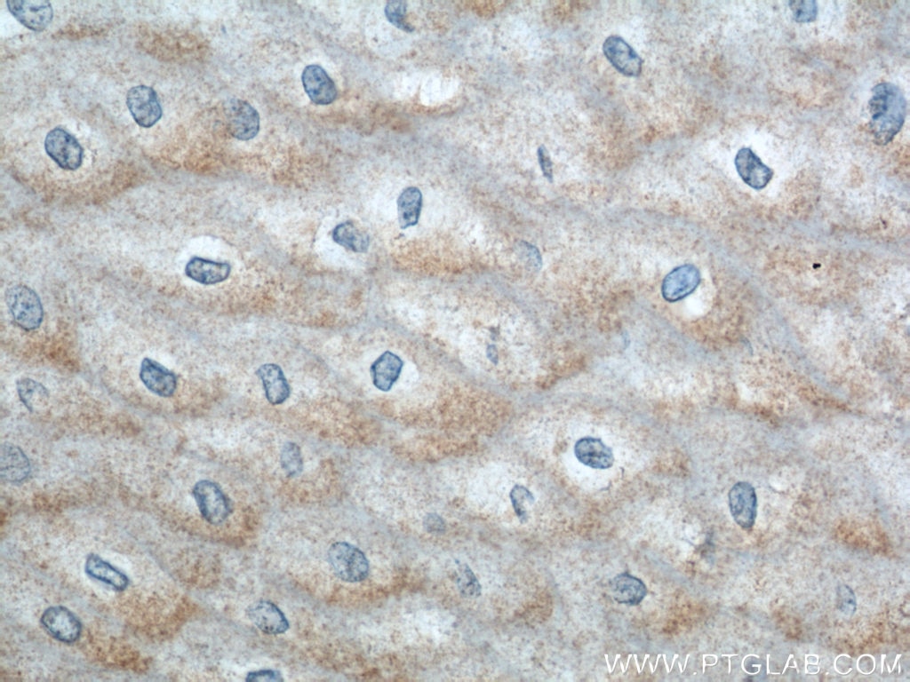 IHC staining of human oesophagus using 11261-2-AP