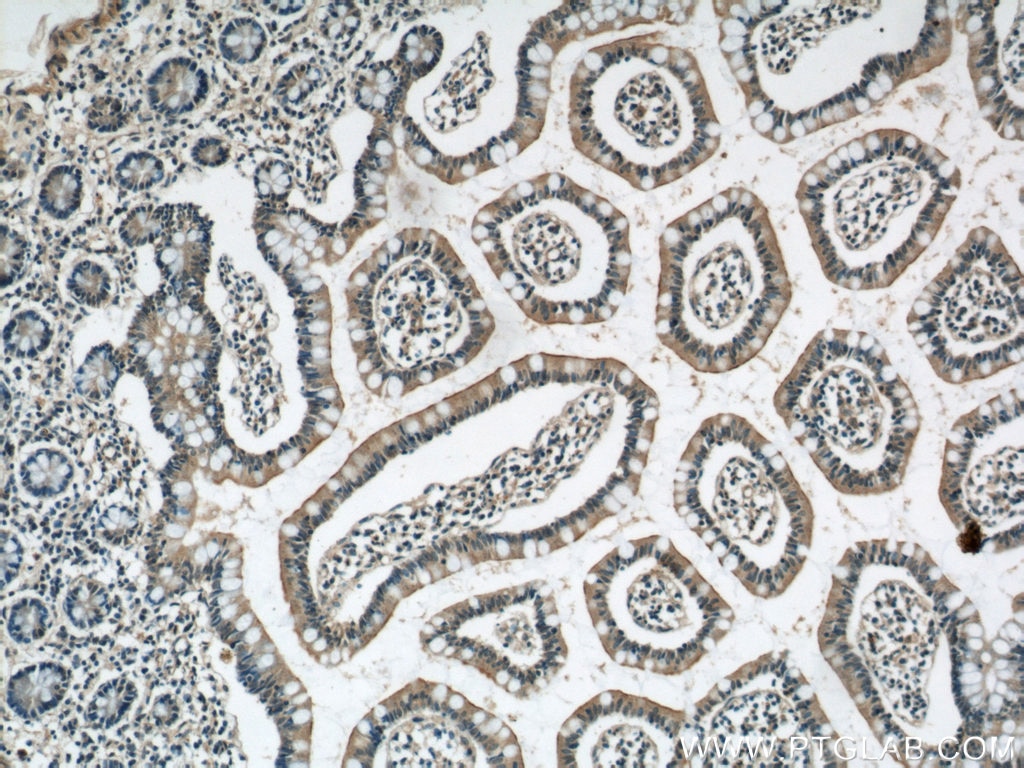 Immunohistochemistry (IHC) staining of human small intestine tissue using ERO1LB Polyclonal antibody (11261-2-AP)