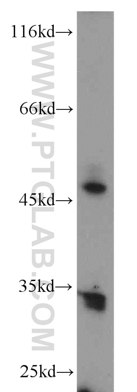 Western Blot (WB) analysis of human placenta tissue using ERO1LB Polyclonal antibody (11261-2-AP)