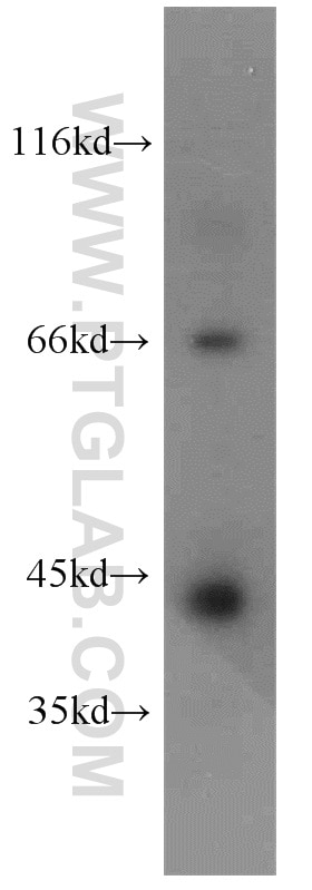 Western Blot (WB) analysis of HeLa cells using ERO1LB Polyclonal antibody (11261-2-AP)