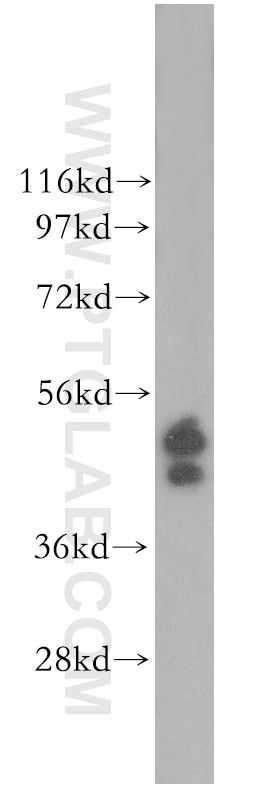 Western Blot (WB) analysis of HeLa cells using ERO1LB Polyclonal antibody (11261-2-AP)