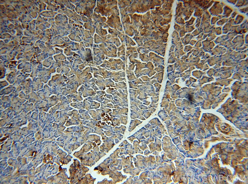 Immunohistochemistry (IHC) staining of human pancreas tissue using ERO1LB Polyclonal antibody (18312-1-AP)