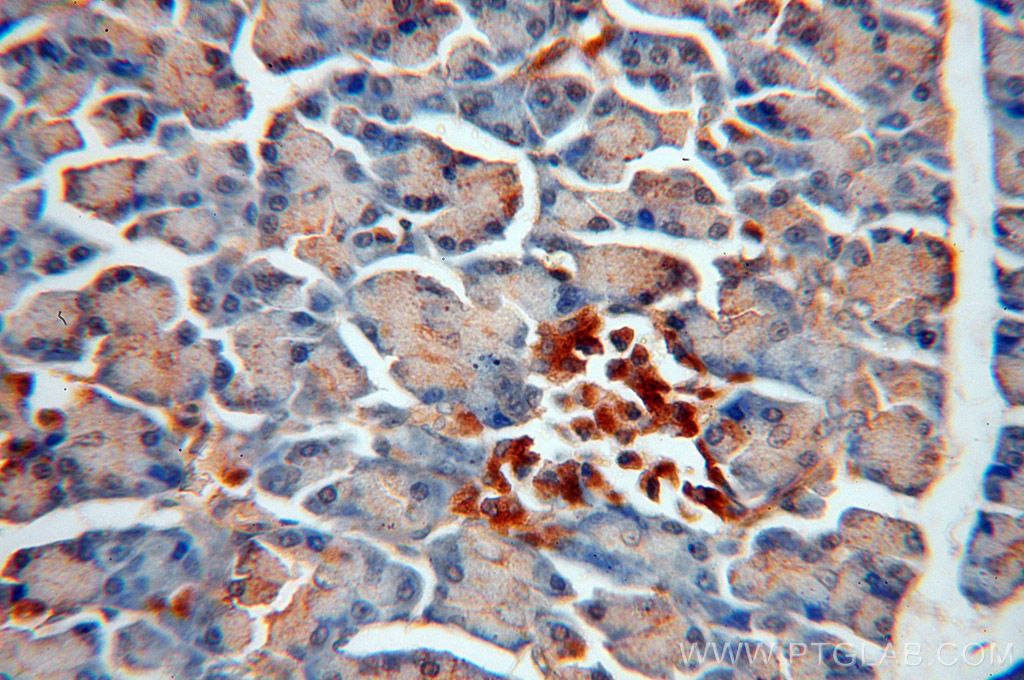Immunohistochemistry (IHC) staining of human pancreas tissue using ERO1LB Polyclonal antibody (18312-1-AP)