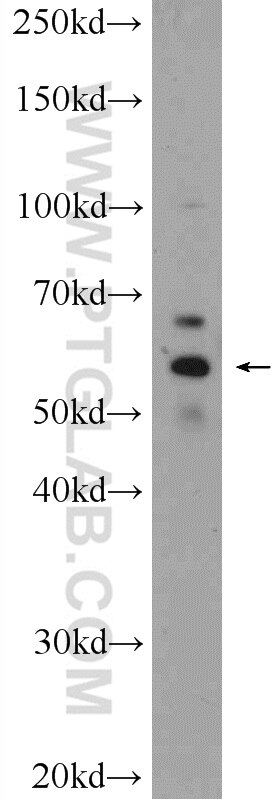 Western Blot (WB) analysis of rat brain tissue using ERO1LB Polyclonal antibody (18312-1-AP)