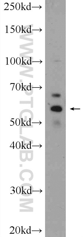 Western Blot (WB) analysis of rat brain tissue using ERO1LB Polyclonal antibody (18312-1-AP)