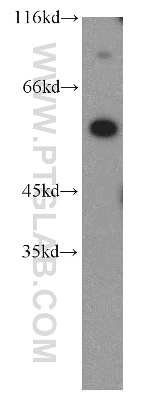 Western Blot (WB) analysis of mouse brain tissue using ERO1LB Polyclonal antibody (18312-1-AP)