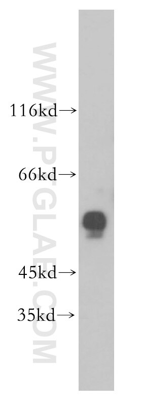 Western Blot (WB) analysis of human brain tissue using ERO1LB Polyclonal antibody (18312-1-AP)