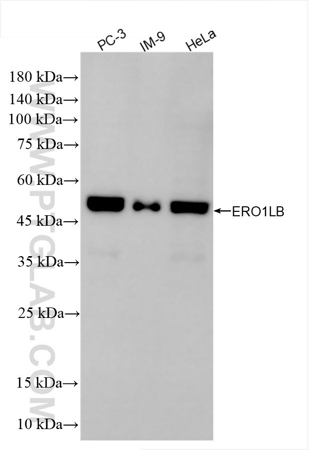 Western Blot (WB) analysis of various lysates using ERO1LB Recombinant antibody (86104-1-RR)