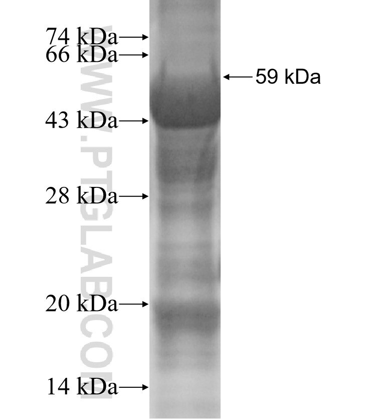 ERO1LB fusion protein Ag1776 SDS-PAGE