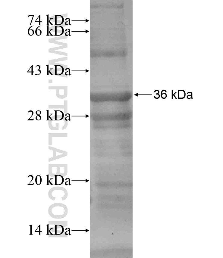 ERO1LB fusion protein Ag17920 SDS-PAGE