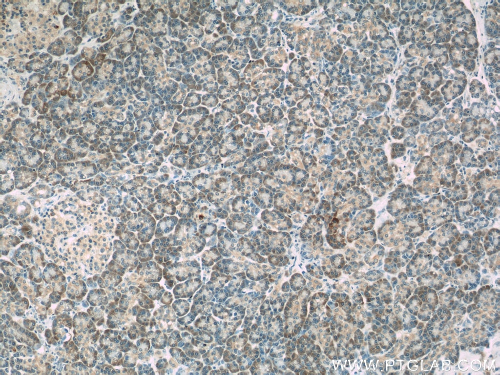 Immunohistochemistry (IHC) staining of human pancreas tissue using ERP29 Polyclonal antibody (24344-1-AP)