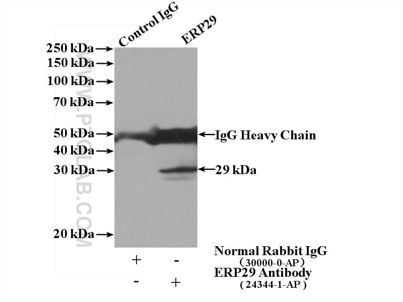 Immunoprecipitation (IP) experiment of mouse liver tissue using ERP29 Polyclonal antibody (24344-1-AP)
