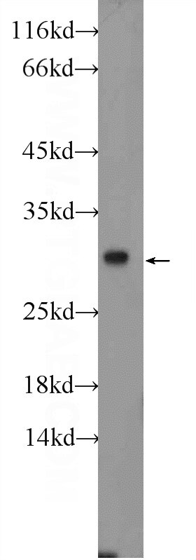 Western Blot (WB) analysis of HEK-293 cells using ERP29 Polyclonal antibody (24344-1-AP)