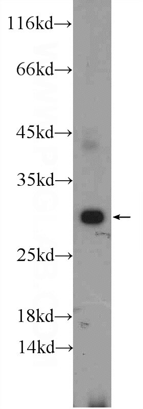 Western Blot (WB) analysis of mouse kidney tissue using ERP29 Polyclonal antibody (24344-1-AP)