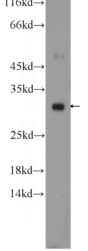 Western Blot (WB) analysis of mouse liver tissue using ERP29 Polyclonal antibody (24344-1-AP)