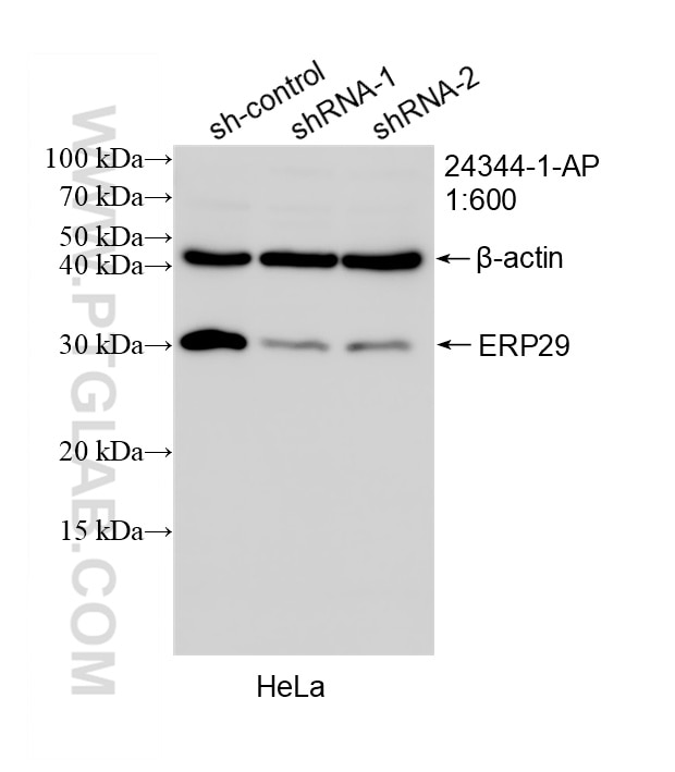Western Blot (WB) analysis of HeLa cells using ERP29 Polyclonal antibody (24344-1-AP)