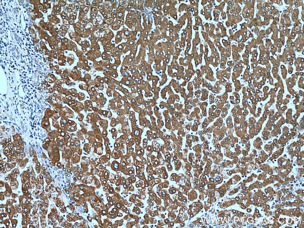 Immunohistochemistry (IHC) staining of human liver tissue using ERP29 Monoclonal antibody (67675-1-Ig)