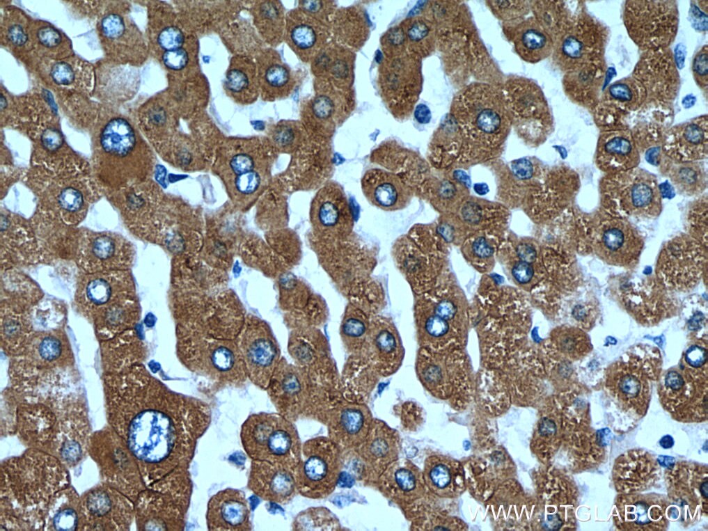Immunohistochemistry (IHC) staining of human liver tissue using ERP29 Monoclonal antibody (67675-1-Ig)