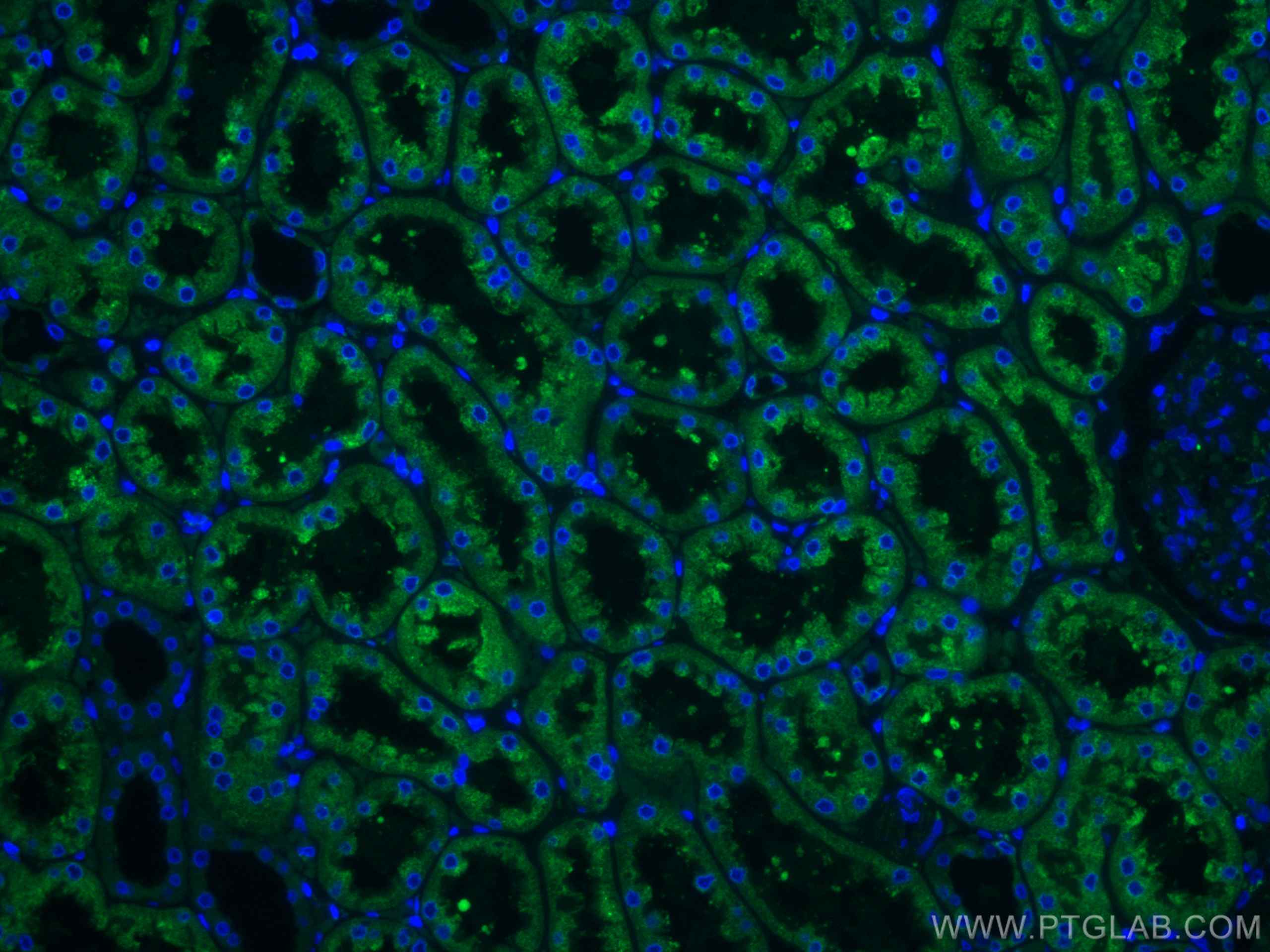 Immunofluorescence (IF) / fluorescent staining of human kidney tissue using CoraLite® Plus 488-conjugated ERP29 Monoclonal ant (CL488-67675)