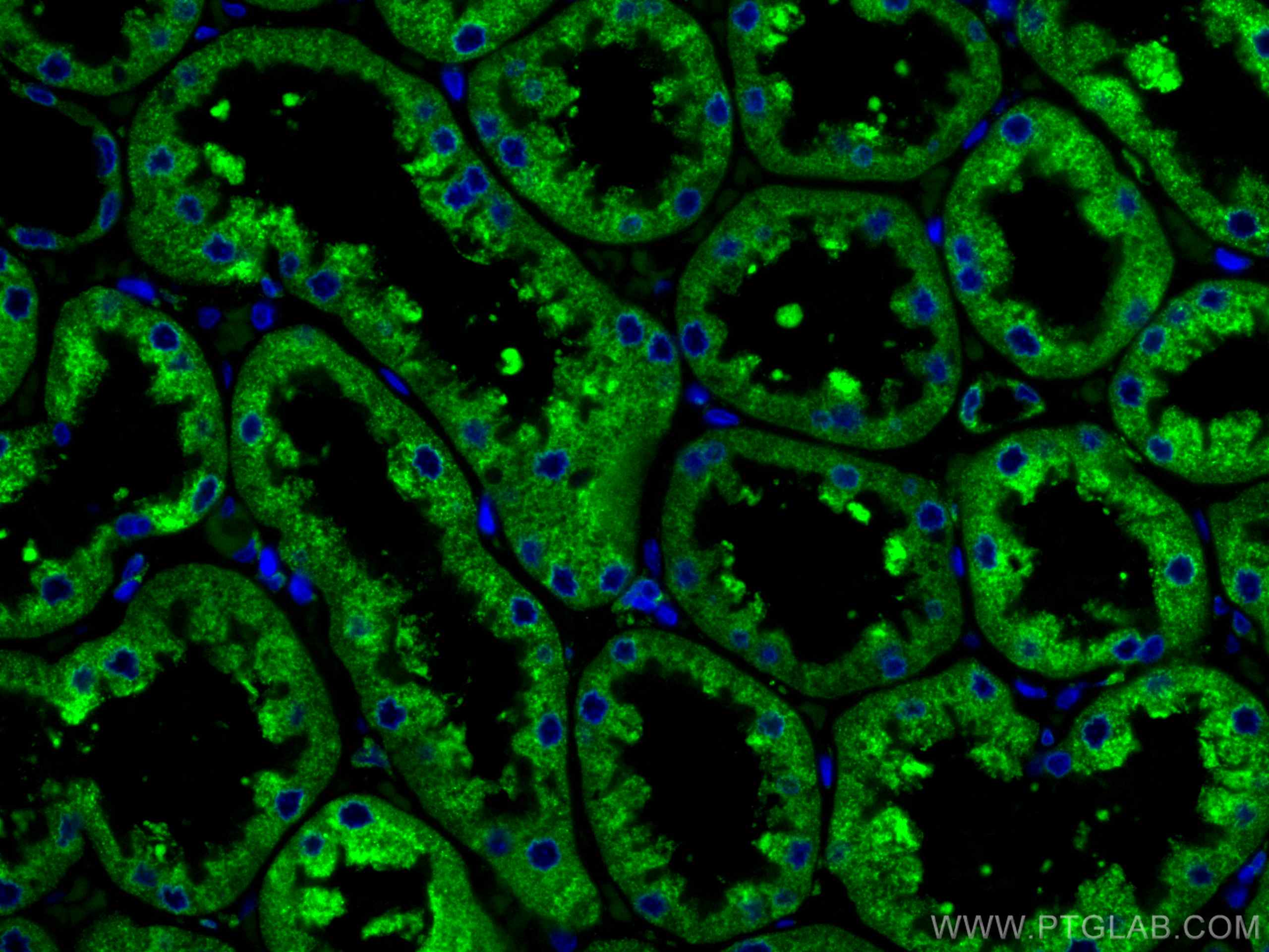 Immunofluorescence (IF) / fluorescent staining of human kidney tissue using CoraLite® Plus 488-conjugated ERP29 Monoclonal ant (CL488-67675)