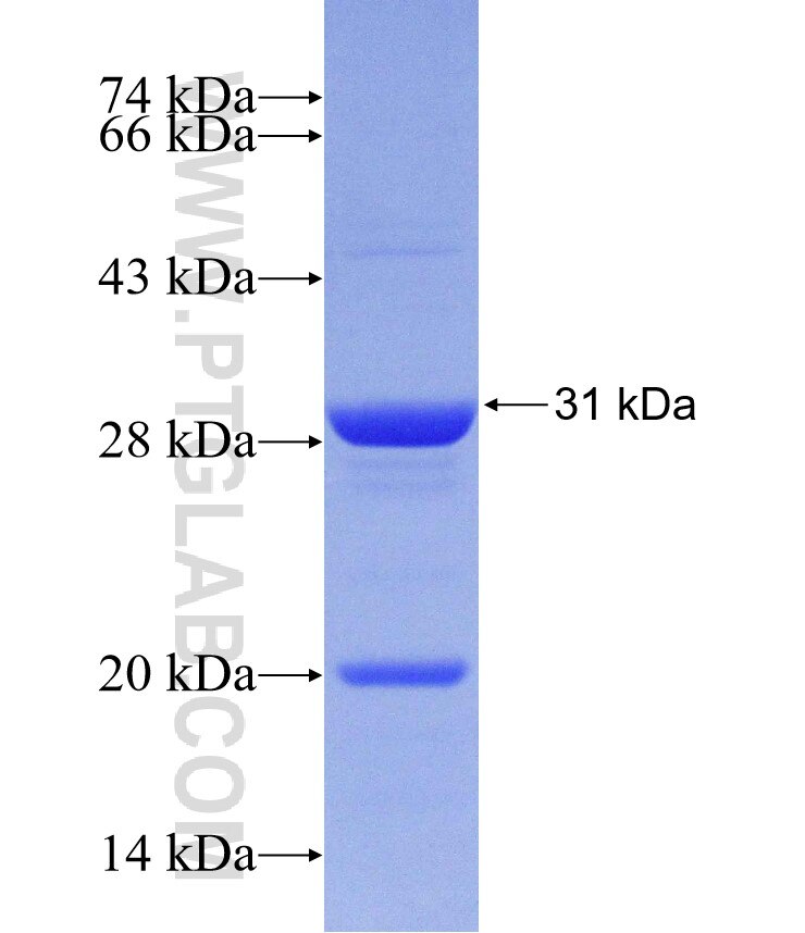 ERP29 fusion protein Ag30262 SDS-PAGE
