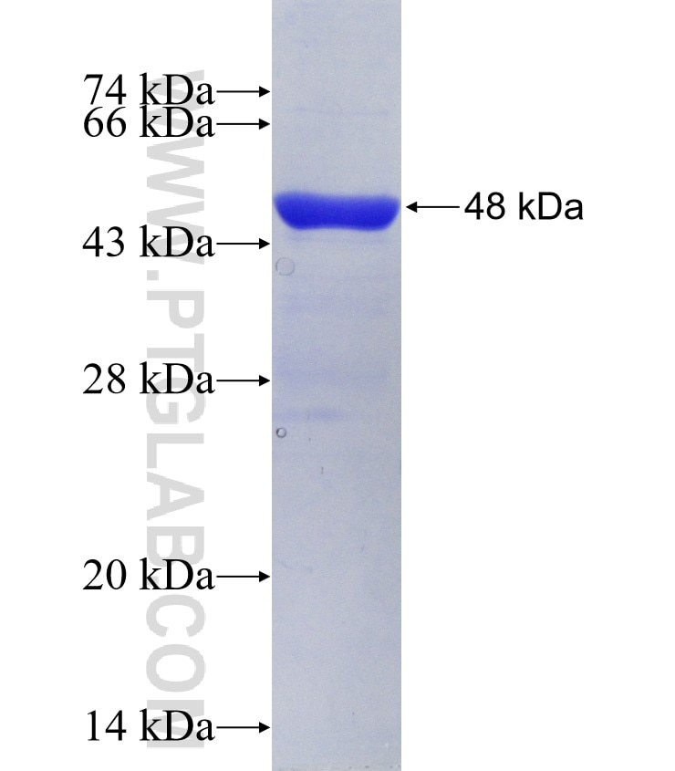 ERP29 fusion protein Ag19451 SDS-PAGE