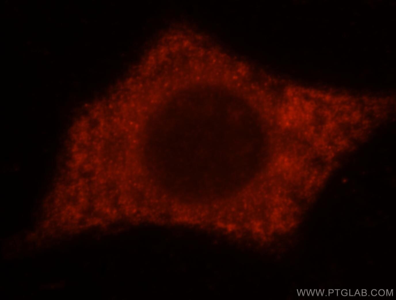 Immunofluorescence (IF) / fluorescent staining of HeLa cells using TXNDC4 Polyclonal antibody (16016-1-AP)
