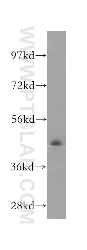 Western Blot (WB) analysis of HeLa cells using TXNDC4 Polyclonal antibody (16016-1-AP)