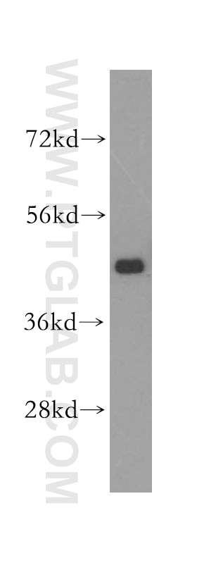 Western Blot (WB) analysis of MCF-7 cells using TXNDC4 Polyclonal antibody (16016-1-AP)