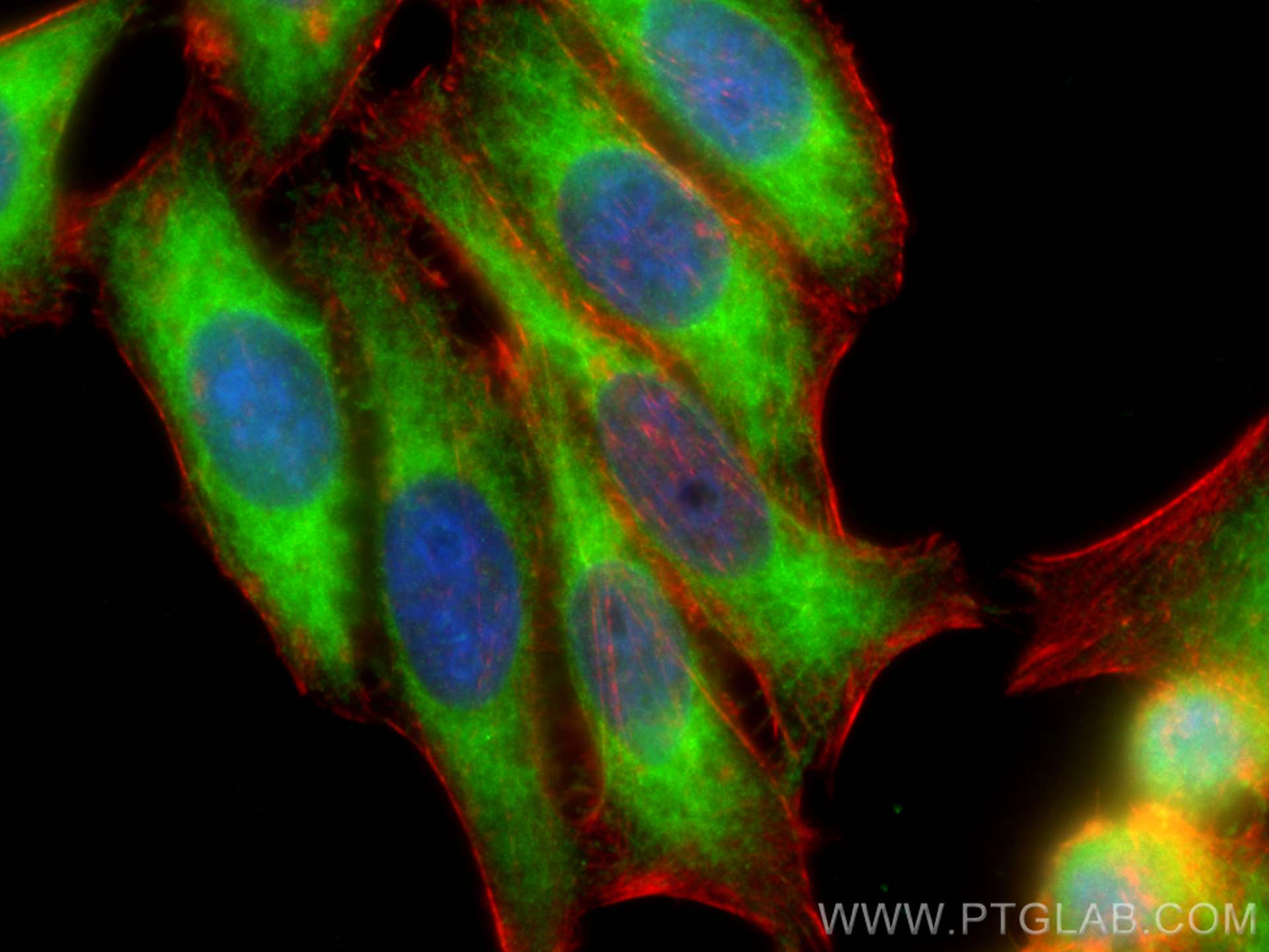Immunofluorescence (IF) / fluorescent staining of HepG2 cells using MIG6; ERRFI1 Polyclonal antibody (11630-1-AP)