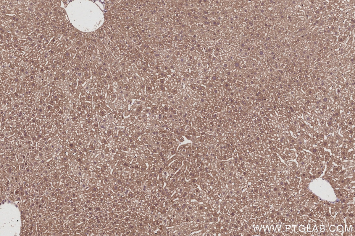 Immunohistochemistry (IHC) staining of mouse liver tissue using MIG6; ERRFI1 Polyclonal antibody (11630-1-AP)