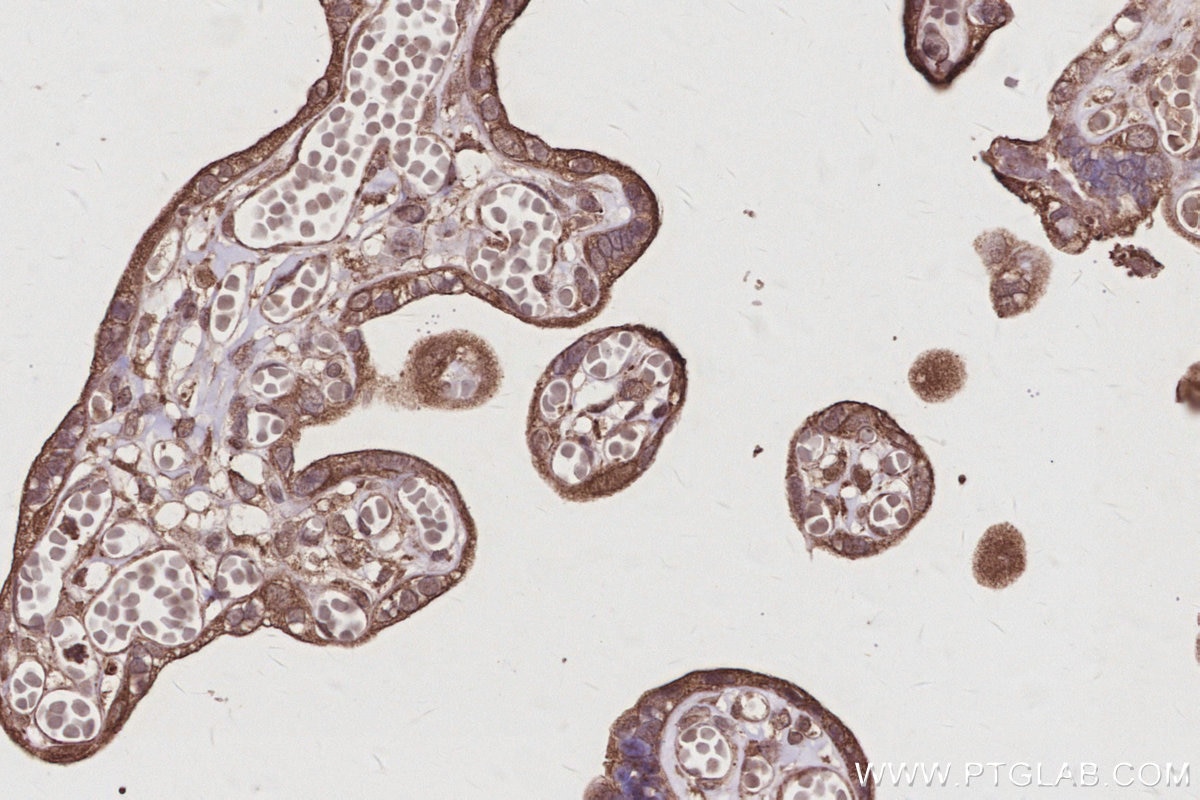 Immunohistochemistry (IHC) staining of human placenta tissue using MIG6; ERRFI1 Polyclonal antibody (11630-1-AP)