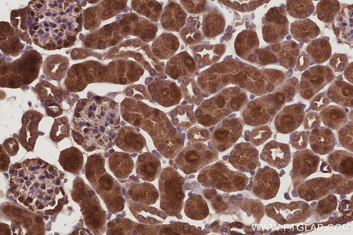 Immunohistochemistry (IHC) staining of mouse kidney tissue using MIG6; ERRFI1 Polyclonal antibody (11630-1-AP)