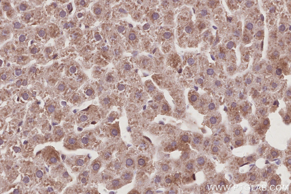 Immunohistochemistry (IHC) staining of rat liver tissue using MIG6; ERRFI1 Polyclonal antibody (11630-1-AP)