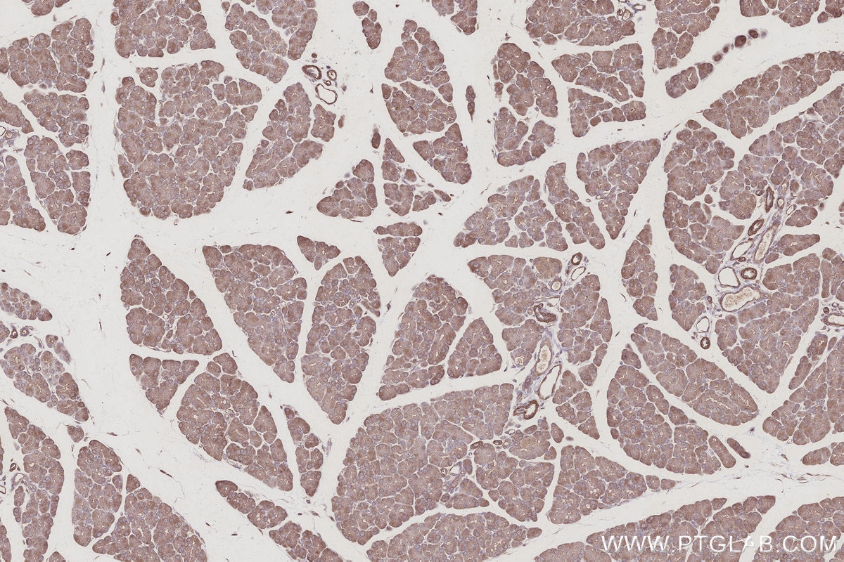 Immunohistochemistry (IHC) staining of rat pancreas tissue using MIG6; ERRFI1 Polyclonal antibody (11630-1-AP)