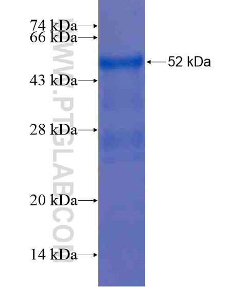MIG6; ERRFI1 fusion protein Ag18763 SDS-PAGE