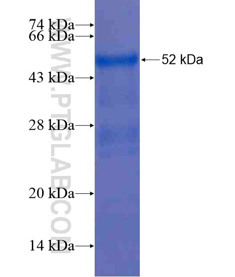 MIG6; ERRFI1 fusion protein Ag18763 SDS-PAGE