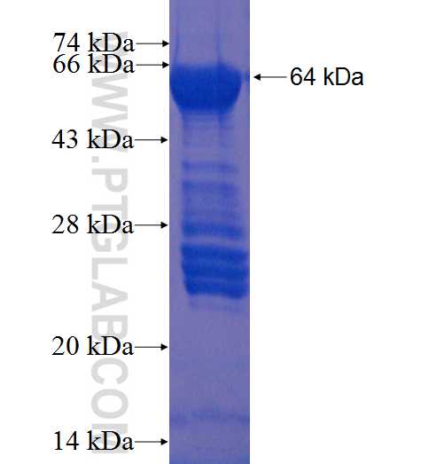 MIG6; ERRFI1 fusion protein Ag2202 SDS-PAGE